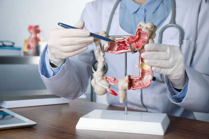 1999071686 Doctor pointing at anatomical model of the colon