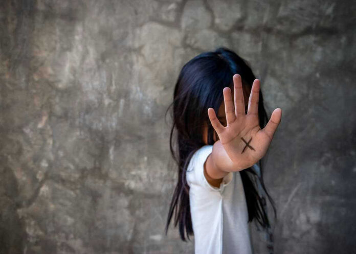 Person with an X on their palm