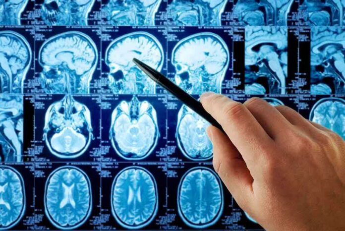 A hand pointing at MRI brain scans displayed on a screen
