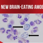 New brain-eating amoeba case in NC: What you need to know