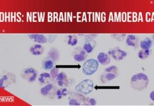 Teen Struck By Brain-Eating Amoeba New brain-eating amoeba case in NC: What you need to know