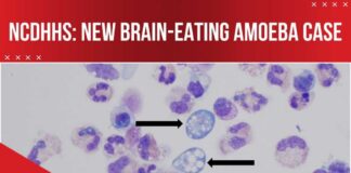 New brain-eating amoeba case in NC: What you need to know